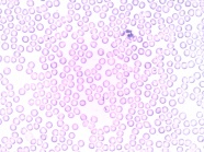 显微镜下中性粒细胞图片