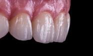 口腔牙齿结构图片